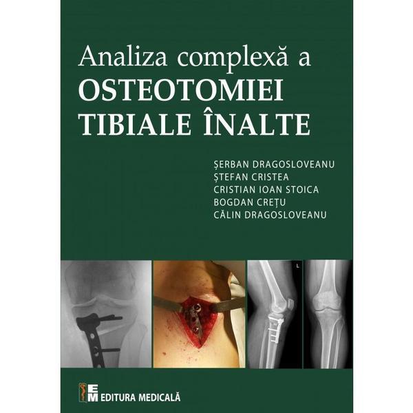 Analiza complexa a Osteotomiei Tibiale Inalte | Serban Dragosloveanu
