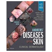 andrews-diseases-of-the-skin.-clinical-dermatology-william-d.-james-dirk-elston-james-r.-treat-misha-a.-rosenbach-isaac-neuhaus.jpg Andrews' Diseases of the Skin. Clinical Dermatology - William D. James, Dirk Elston, James R. Treat, Misha A. Rosenbach, Isaac Neuhaus