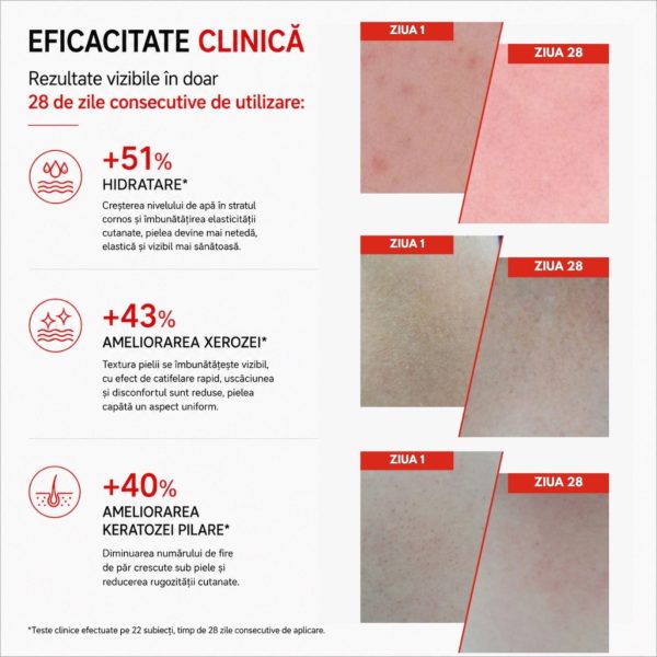 Xerocare Cremă Hidratantă Și Ușor Keratolitică Cu 10% Uree, Ceramide Vegetale Și Squalan Din Măsline - 250ml